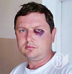 Директор цегельного заводу побив працівника, бо той вимагав зарплату Директор цегельного заводу побив працівника, бо той вимагав зарплату