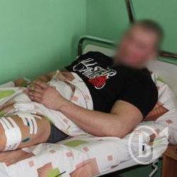 Стан поранених в Чернігові поліцейських стабільний Стан поранених в Чернігові поліцейських стабільний