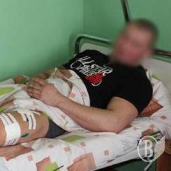 Стан поранених в Чернігові поліцейських стабільний