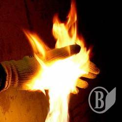 Обпікся бензином вдома Обпікся бензином вдома